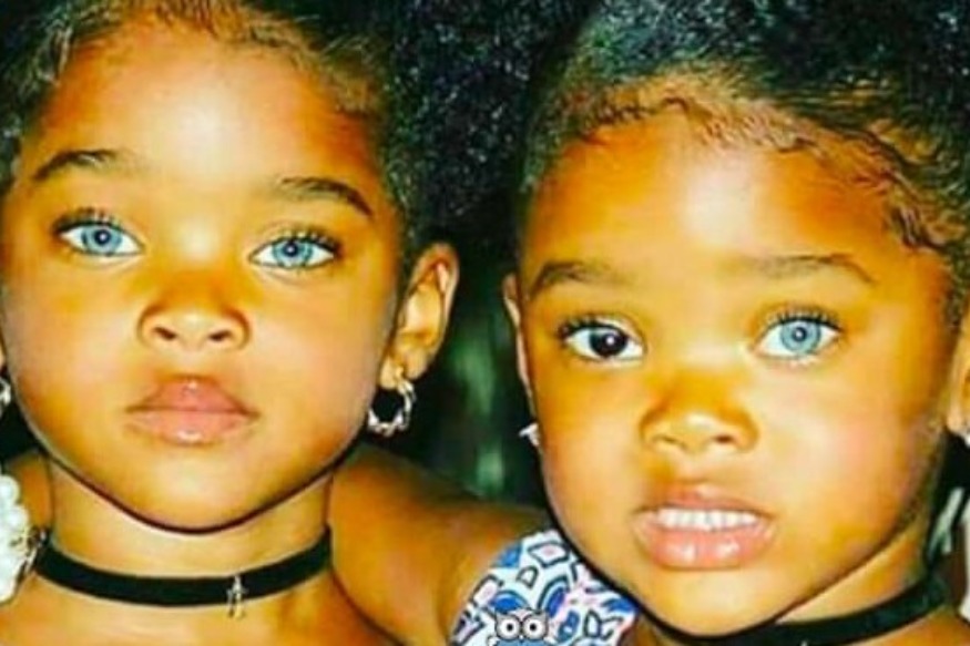 PEOPLE : PHOTO – Il y a quelques années, ces jumelles ont enchanté le monde : voici à quoi elles ressemblent maintenant