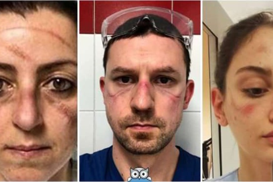 PEOPLE : Le personnel soignant montre son quotidien difficile : avec des PHOTOS de leurs visages douloureux